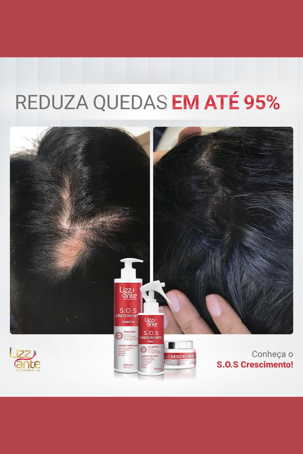 Como Diminuir A Queda De Cabelo Femenino